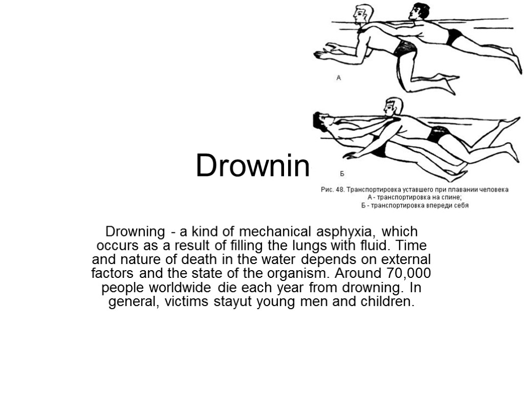 Drowning Drowning - a kind of mechanical asphyxia, which occurs as a result of